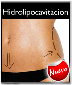 Hidrolipocavitación